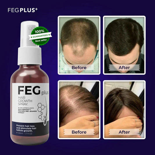 FEG Plus Hair Growth Spray (Original)